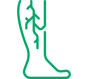 Cirugía Vascular
